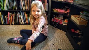 Father Builds Daughter's Robotic Arm with No Experience