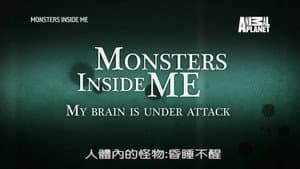 My Brain Is Under Attack