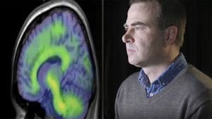 Alzheimer's - Can We Prevent It?