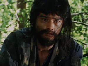 Episode 31
