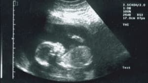 50 Fetus - In Da Whomb