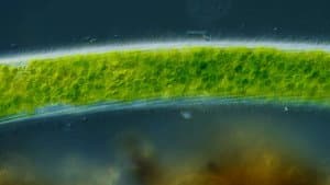 We Found a Super Rare Microbe!